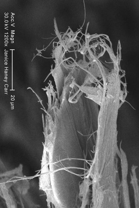 Asbestfasern unter Elektronen-Mikroskop Asbestfasern unter Elektronen-Mikroskop